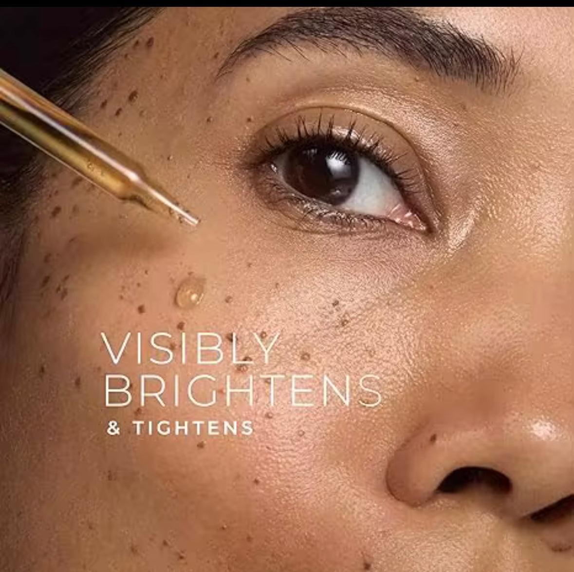 MRUIS Skin Whitening Serum – Niacinamide & Kojic Acid (30ml)